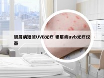 银屑病短波UVB光疗 银屑病uvb光疗仪器