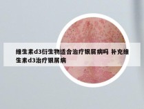 维生素d3衍生物适合治疗银屑病吗 补充维生素d3治疗银屑病