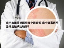 南宁治银屑病医院哪个最好呢 南宁哪家医院治疗皮肤病比较好?