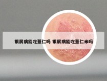 银屑病能吃薏仁吗 银屑病能吃薏仁米吗