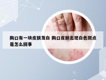 胸口有一块皮肤发白 胸口皮肤出现白色斑点是怎么回事