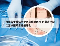 内蒙古中益仁堂中医皮肤病医院 内蒙古中益仁堂中医院看痘痘好么