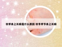 秋季身上长癣是什么原因 秋冬季节身上长癣