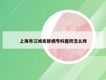 上海市江城皮肤病专科医院怎么样