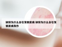 缺锌为什么会引发银屑病 缺锌为什么会引发银屑病发作