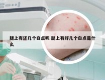 腿上有还几个白点呢 腿上有好几个白点是什么