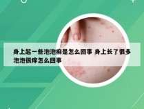 身上起一些泡泡癣是怎么回事 身上长了很多泡泡很痒怎么回事