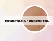 白殿疯是对称长的吗 白殿疯病能彻底治好吗