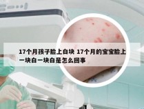 17个月孩子脸上白块 17个月的宝宝脸上一块白一块白是怎么回事