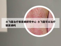 小飞蓬治疗银屑病研究中心 小飞蓬可以治疗银屑病吗