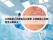 小孩脑袋上长癣是怎么回事 小孩脑袋上长癣是怎么回事儿