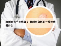 胳膊肘有一小块白了 胳膊肘白色的一片疙瘩是什么