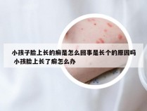 小孩子脸上长的癣是怎么回事是长个的原因吗 小孩脸上长了癣怎么办