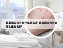 银屑病应该补充什么维生素 银屑病应该补充什么维生素好