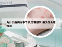 为什么癣病治不了根,容易服发 癣为什么难根治