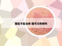 醋能不能治癣 醋可以擦癣吗