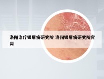 洛阳治疗银屑病研究院 洛阳银屑病研究院官网