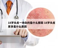 18岁头皮一块白的是什么原因 18岁头皮屑多是什么原因