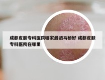 成都皮肤专科医院哪家最驷马桥好 成都皮肤专科医院在哪里