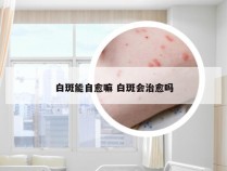 白斑能自愈嘛 白斑会治愈吗