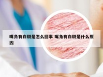 嘴角有白斑是怎么回事 嘴角有白斑是什么原因