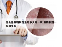 什么是生物制剂治疗多久用一次 生物制剂一般用多久