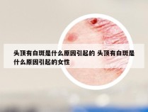 头顶有白斑是什么原因引起的 头顶有白斑是什么原因引起的女性