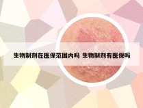 生物制剂在医保范围内吗 生物制剂有医保吗