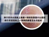 四个月大小孩身上有癣一样的东西是什么原因 四个月宝宝身上一块块的癣是怎么引起的