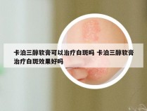 卡泊三醇软膏可以治疗白斑吗 卡泊三醇软膏治疗白斑效果好吗