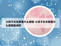 小孩子头长癣是什么原因 小孩子头长癣是什么原因造成的