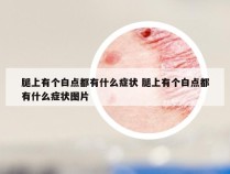 腿上有个白点都有什么症状 腿上有个白点都有什么症状图片