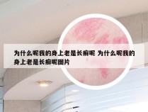 为什么呢我的身上老是长癣呢 为什么呢我的身上老是长癣呢图片