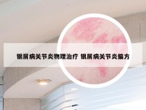 银屑病关节炎物理治疗 银屑病关节炎偏方