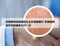 生物制剂皮肤病在什么时候需要打 生物制剂治疗皮肤病多久打一次