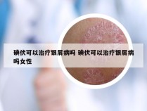 碘伏可以治疗银屑病吗 碘伏可以治疗银屑病吗女性