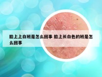 脸上上白班是怎么回事 脸上长白色的班是怎么回事