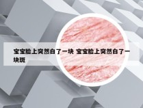 宝宝脸上突然白了一块 宝宝脸上突然白了一块斑