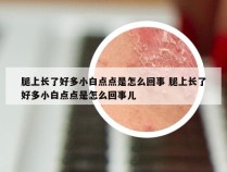 腿上长了好多小白点点是怎么回事 腿上长了好多小白点点是怎么回事儿