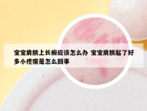 宝宝肩膀上长癣应该怎么办 宝宝肩膀起了好多小疙瘩是怎么回事