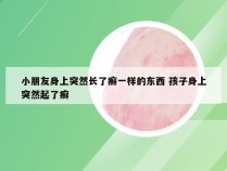 小朋友身上突然长了癣一样的东西 孩子身上突然起了癣