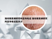 潍坊银屑病研究所咨询电话 潍坊银屑病研究所咨询电话是多少