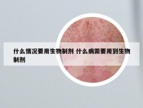 什么情况要用生物制剂 什么病需要用到生物制剂