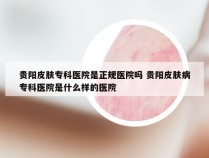 贵阳皮肤专科医院是正规医院吗 贵阳皮肤病专科医院是什么样的医院