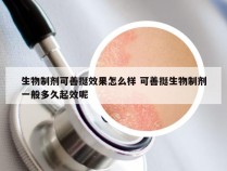 生物制剂可善挺效果怎么样 可善挺生物制剂一般多久起效呢