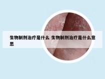 生物制剂治疗是什么 生物制剂治疗是什么意思