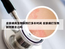 皮肤病用生物制剂打多长时间 皮肤病打生物制剂要忌口吗