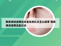 银屑病消退期还反复出现红点怎么回事 银屑病消退期还起红点