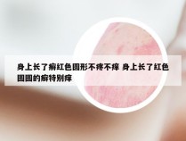 身上长了癣红色圆形不疼不痒 身上长了红色圆圆的癣特别痒