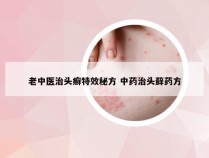 老中医治头癣特效秘方 中药治头藓药方